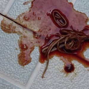 mi perro vomita sangre parasitos intestinales